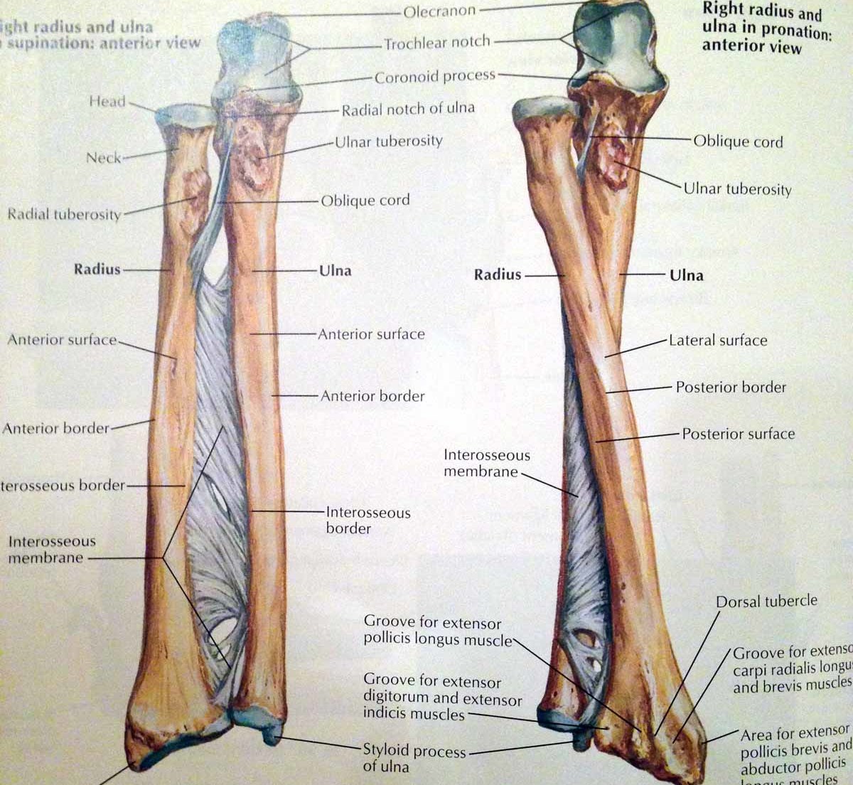 forearmBones